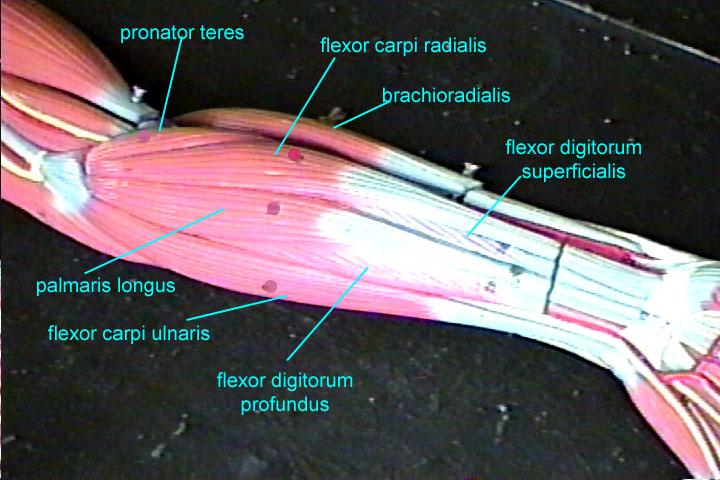 Lab Practical 2 Front/back Axial And ARM Flashcards by ProProfs